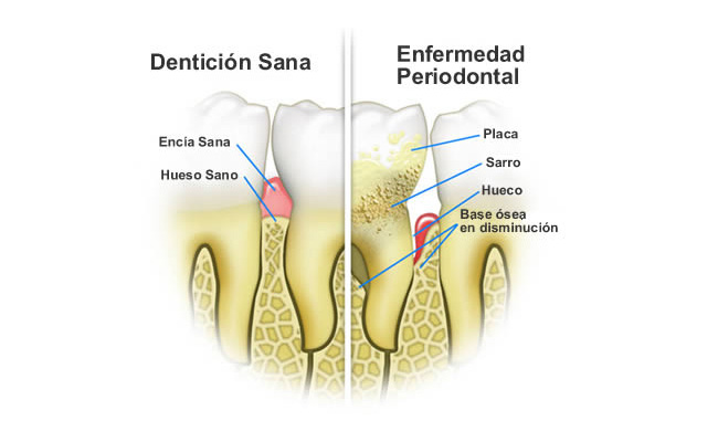 dentaelen-periodoncia-02